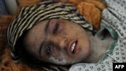 Ўтган йили Афғонистонда ўз эри яқинлари томонидан зўрланиб, қийноққа солинган Саҳаргул воқеаси кўпчиликни даҳшатга солган эди.