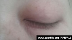 24-летняя Латофат Рахимова утверждает, что ее избил сотрудник милиции.