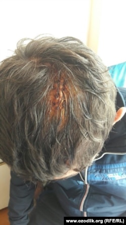 Amakisining iddaosicha, Hurshid Sarabekovni boshini ketmon sopi bilan urib yorishgan.