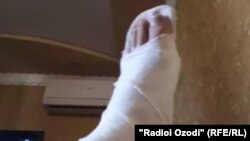 У Саидасрора во время спасения девушки была сломана нога