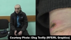 Колишній ув'язнений колонії Денис Кметь та рани від тортур