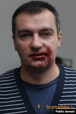 Дмитро Гнап