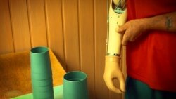 Протезная мастерская в Харькове, фотография из книги "Ампутация"