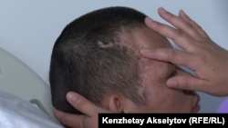 Гүлмира Мұқажанова әскери оқуда жүріп, жұмбақ жағдайда жараланған ұлы Ұлан Мұсаев бас сүйегінің бөлігінен айырылғанын көрсетіп тұр.