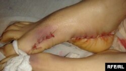 Ўзбекистон расмийлари икки ҳафта ичида сил ëки церроздан ўлган одамнинг танасидаги бу жароҳатларнинг қайдан келганини ҳозирча изоҳлашни истамаяптилар.