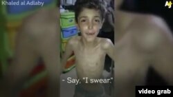 کودکان در شهر سوری مضایا با گرسنگی دست و پنجه نرم می‌کنند.