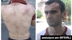 Активист Андраник Асланян