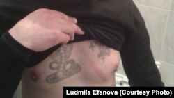 Фотоснимок следов побоев, как утверждает в своем заявлении содержащийся в учреждении ЛА-155/12 в поселке Заречный Алматинской области 33-летний заключенный Андрей Ефанов, полученных им 17 апреля 2018 года от бойцов внутренних войск и сотрудника учреждения.