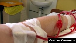 Süni böyrək rolunu oynayan hemodializ aparatları təxminən 3-4 saatlıq seans zamanı qanı bədəndən kənar təmizləyir