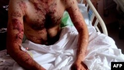 یکی از مجروحان سوری در بیمارستانی در ترکیه