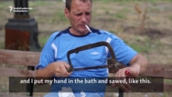 Russian Man Cuts Off Finger, Alleging Police Raped His Wife