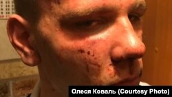 Фотографии Вадима Коваля, сделанные его матерью после задержания полицейскими