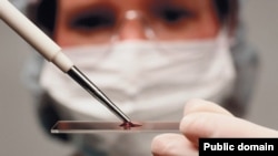 Alym gan barlagyny geçirýär 