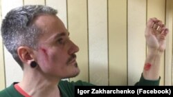 В Одесі побили ЛГБТ-активіста Ігоря Захарченка