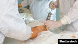 Одне з нагальних завдань, повідомляють у МОЗ – отримати доступ до міжнародної бази живих донорів кісткового мозку