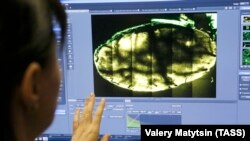 Көп фотондуу микроскоп аркылуу мээни изилдөө. Ростов-Дон шаарындагы Түштүк федералдык университет, Орусия. 2019-жылдын 8-февралы.