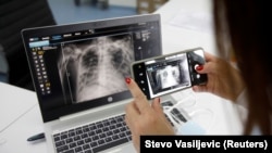 "Бүт эле вирустар, анын ичинде метапневмовирус да убагында дарыланбаса пневмония, бронхитке алып келет". Сүрөт иллюстрация үчүн колдонулду. Макалага тиешеси жок