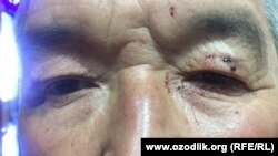 Ташкентский дворник Бахтияр Маматов утверждает, что сотрудники патрульно-постовой службы били его дубинками, приняв за бомжа. 