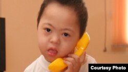 Гепатитпен ауырған Айбек.  