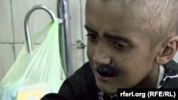 Лейкемиядан азият чекаётган афғонистонлик бола.