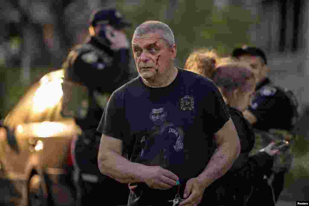 Раненый мужчина идёт по месту российского ракетного удара в жилом районе на фоне атаки России на Украину, Харьков, Украина, 18 апреля 2025 года. REUTERS/Marko Djurica