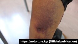 Барымтага алынган кыргызстандык.