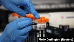 Коронавирусту лабораториялык жол менен аныктоо учуру.