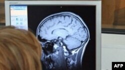 Мозг человека на экране томографа