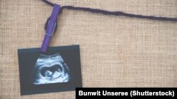 سازمان‌های امضاکنندهٔ این بیانیه از جمهوری اسلامی خواسته‌اند «برنامه‌های جامع تنظیم خانواده» را احیا و قوانین جرم‌انگاری سقط جنین را «فوراً» لغو کند