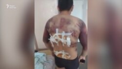 Прижечь утюгом и избить — нанести легкий вред здоровью? Что происходит с делом о пытках