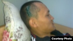 Заключенный Искандер Тюгельбаев лежит в тюремной лечебнице после полученной травмы головы. Фото из семейного архива. 