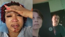 Темнокожая россиянка заявила об избиении соседями