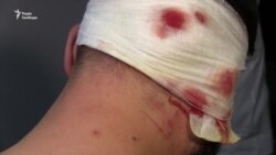 У Харкові невідомі побили антикорупціонера і депутата облради (відео)