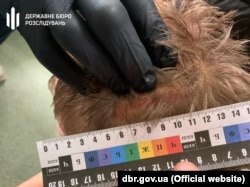 Потерпілий отримав травми голови, обличчя і тулуба