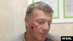 Алег Сурган быў дастаўлены ў суд пабітым