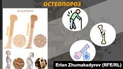 Остеопорозго чалдыккан адамдын көбүнчө жамбаш сөөгү, омурткасы, билеги жабыркайт.