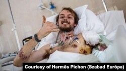 Едді, британський волонтер в Україні, відновлюється після поранень у лікарні в Дніпрі, 1 лютого 2025 року